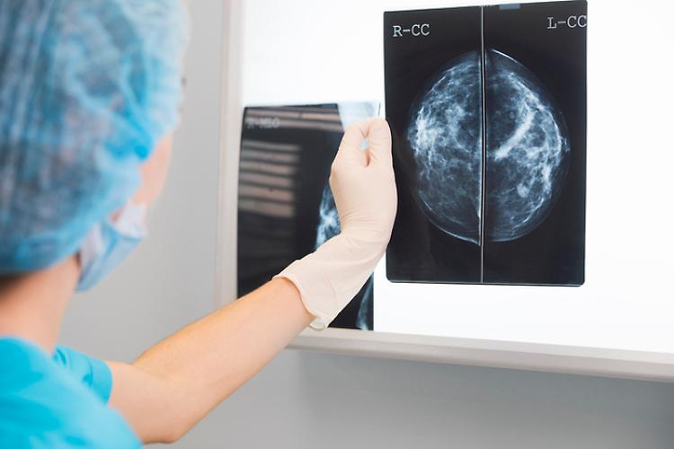 Cancro, l'arma di difesa è la prevenzione