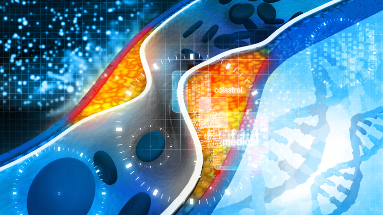 Colesterolo cattivo, farmaco a mRNA lo dimezza