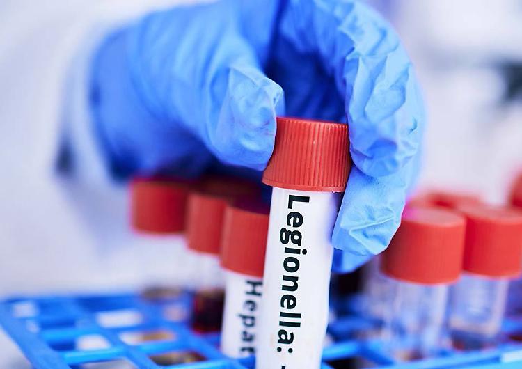 Uccisa dalla legionella, maxi risarcimento