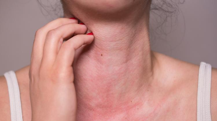 Gravi allergie, arriva lo spray nasale: alternativa semplice all’iniezione salvavita