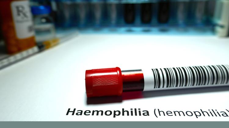 Prima terapia genica contro l’emofilia B somministrata in Italia