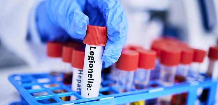 Anziana morta di legionella, il pm chiede otto mesi