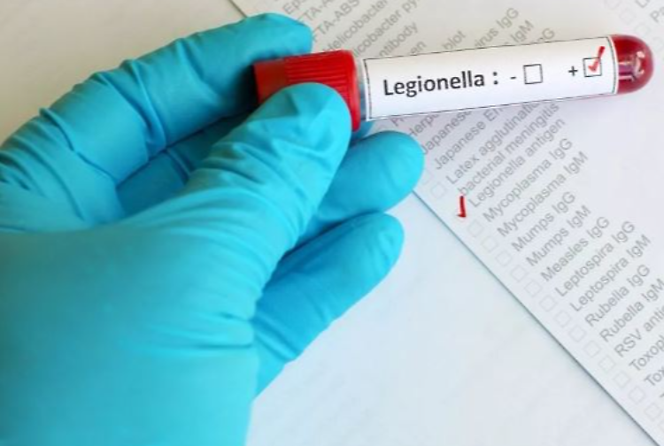 Legionella, 65enne cremonese muore dopo 4 giorni di ricovero