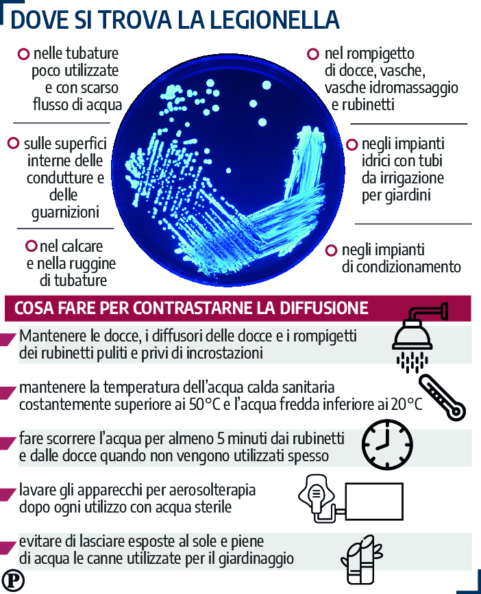 legionella